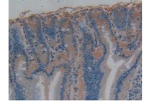 Detection of MAPT in Rat Intestine Tissue using Polyclonal Antibody to Tau Protein (MAPT)