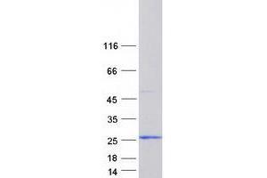 Western Blotting (WB) image for Ionized Calcium-binding Adapter Molecule 2 (IBA2) (Transcript Variant 1) protein (Myc-DYKDDDDK Tag) (ABIN2714480)