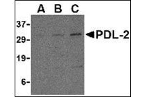 Western blot analysis of PDL-2 in Raji cell lysate with this product at (A) 0. (PDCD1LG2 抗体  (Center))
