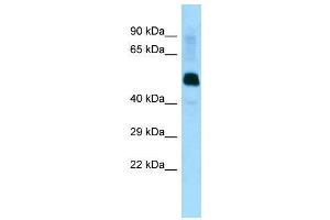 Host:  Rabbit  Target Name:  Lrrfip1  Sample Type:  Mouse Muscle lysates  Antibody Dilution:  1. (LRRFIP1 抗体  (Middle Region))
