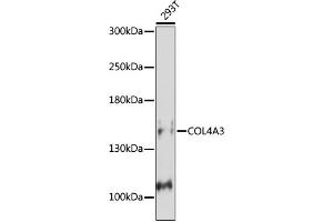 Western blot analysis of extracts of Mouse kidney, using COL4 antibody (ABIN7266460) at 1:1000 dilution. (COL4a3 抗体  (C-Term))