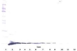 Image no. 2 for anti-Nerve Growth Factor (NGF) antibody (ABIN465645) (Nerve Growth Factor 抗体)