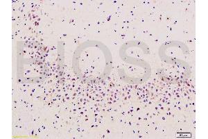 Immunohistochemistry (IHC) image for anti-Prostaglandin-Endoperoxide Synthase 2 (Prostaglandin G/H Synthase and Cyclooxygenase) (PTGS2) (AA 501-604) antibody (ABIN672471)
