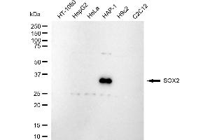 Western blotting analysis using SOX2 antibody (ABIN7800431).