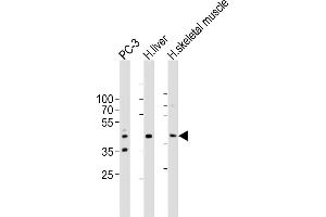 Western blot analysis of lysates from PC-3 cell line, human liver, human skeletal muscle tissue lysate(from left to right), using POC1A Antibody (C-term) ABIN6577916. (POC1A 抗体  (C-Term))