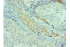 Immunohistochemistry of paraffin-embedded human testis tissue using ABIN7145198 at dilution of 1:100 (BIRC2 抗体  (AA 1-300))