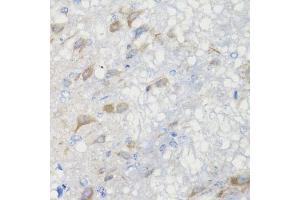 Immunohistochemistry (IHC) image for anti-Cysteine-Rich Hydrophobic Domain 2 (CHIC2) (AA 1-165) antibody (ABIN6138533)