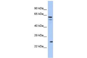 Host: Rabbit Target Name: AQP5 Sample Type: COLO205 Whole cell lysates Antibody Dilution: 1. (Aquaporin 5 抗体  (C-Term))