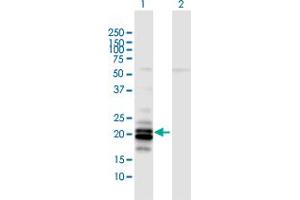 Western Blot analysis of LCN2 expression in transfected 293T cell line by LCN2 MaxPab polyclonal antibody. (Lipocalin 2 抗体  (AA 1-198))