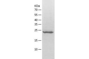 Western Blotting (WB) image for Insulin-Like Growth Factor Binding Protein 1 (IGFBPI) (AA 26-259) protein (His tag) (ABIN7123458) (IGFBPI Protein (AA 26-259) (His tag))