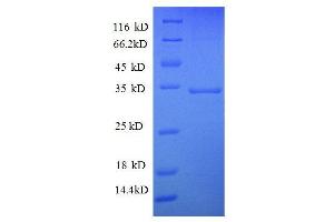 SDS-PAGE (SDS) image for Succinate Dehydrogenase Complex, Subunit A, Flavoprotein (Fp) (SDHA) (AA 44-293), (partial) protein (GST tag) (ABIN7479231)