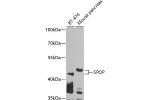 Western blot analysis of extracts of various cell lines, using SPOP antibody (ABIN6130703, ABIN6148374, ABIN6148376 and ABIN6223537) at 1:1000 dilution. (SPOP-B 抗体  (AA 1-270))