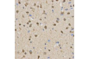 Immunohistochemistry of paraffin-embedded mouse brain using TLE1 antibody at dilution of 1:200 (x400 lens). (TLE1 抗体)
