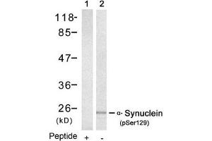 Western blot analysis of extracts from mouse brain tissue using a-Synuclein(Phospho-Ser129) Antibody(Lane 2) and the same antibody preincubated with blocking peptide(Lane1). (SNCA 抗体  (pSer129))