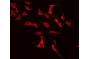 ABIN6272335 staining HeLa by IF/ICC. (KCNJ5 抗体  (N-Term))