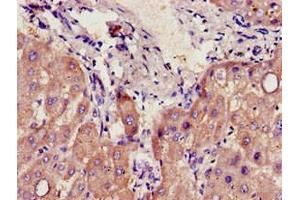 Immunohistochemistry of paraffin-embedded human liver tissue using ABIN7142182 at dilution of 1:100 (CYP39A1 抗体  (AA 235-392))