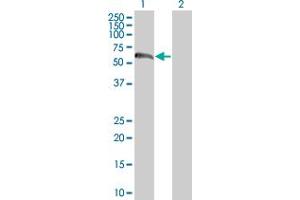Western Blot analysis of ZNF394 expression in transfected 293T cell line by ZNF394 MaxPab polyclonal antibody. (ZNF394 抗体  (AA 1-561))