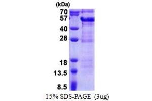 DBR1 Protein (AA 228-544) (His tag)