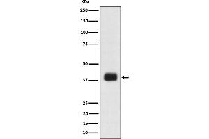 Western blot analysis of SR protein repeat expression in K562 cell lysate.