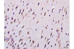 Paraformaldehyde-fixed, paraffin embedded rat brain tissue, Antigen retrieval by boiling in sodium citrate buffer(pH6) for 15min, Block endogenous peroxidase by 3% hydrogen peroxide for 30 minutes, Blocking buffer (normal goat serum) at 37°C for 20min, Antibody incubation with Rabbit Anti-MYCBP2 Polyclonal Antibody, Unconjugated  at 1:400 overnight at 4°C, followed by a conjugated secondary and DAB staining (MYCBP2 抗体  (AA 60-100))
