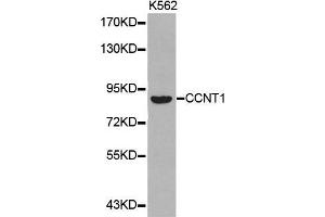 Western blot analysis of extracts of K562 cell lines, using CCNT1 antibody. (Cyclin T1 抗体  (AA 220-320))