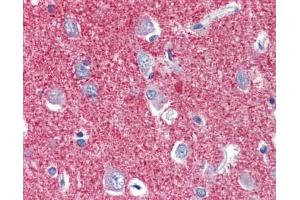 SLC25A28 antibody was used for immunohistochemistry at a concentration of 4-8 ug/ml. (SLC25A28 抗体  (C-Term))