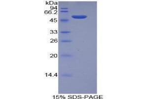 SDS-PAGE analysis of Mouse Integrin alpha 6 Protein. (ITGA6 蛋白)