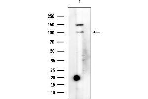 anti-ADAM Metallopeptidase Domain 9 (ADAM9) (C-Term) antibody