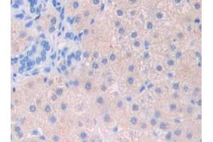 Used in DAB staining on fromalin fixed paraffin- embedded stomach cancer tissue (FIL1d 抗体  (AA 12-151))