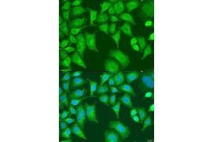 Immunofluorescence analysis of U2OS cells using SQSTM1 antibody. (SQSTM1 抗体  (AA 1-440))