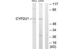 Western blot analysis of extracts from HeLa/Lovo cells, using Cytochrome P450 2U1 Antibody. (CYP2U1 抗体  (AA 281-330))