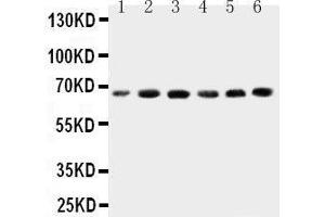 Anti-CETP antibody, Western blotting Lane 1: HELA Cell Lysate Lane 2: COLO320 Cell Lysate Lane 3:  Cell Lysate Lane 4: JURKAT Cell Lysate Lane 5: RAJI Cell Lysate Lane 6: MCF-7 Cell Lysate (CETP 抗体  (C-Term))