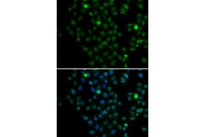Immunofluorescence analysis of MCF-7 cells using LMO4 antibody (ABIN4904242). (LMO4 抗体)