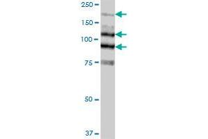 MYLK MaxPab polyclonal antibody. (MYLK 抗体  (AA 1-992))