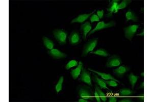 Image no. 1 for anti-Neural Wiskott-Aldrich syndrome protein (WASL) (AA 97-185) antibody (ABIN598590) (Neural Wiskott-Aldrich syndrome protein (WASL) (AA 97-185) 抗体)