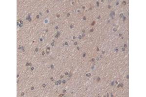 Used in DAB staining on fromalin fixed paraffin- embedded brain tissue (CABIN1 抗体  (AA 23-288))