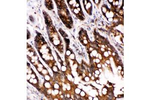 Anti-Caspase-6(P18) antibody,  IHC(P) IHC(P): Rat Intestine Tissue (Caspase 6 抗体  (N-Term))