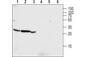 Chloride Intracellular Channel 4 (CLIC4) peptide