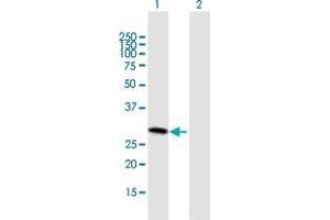 Western Blot analysis of SLC25A27 expression in transfected 293T cell line by SLC25A27 MaxPab polyclonal antibody. (SLC25A27 抗体  (AA 1-245))