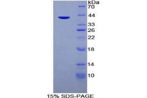 SDS-PAGE analysis of Human Mucin 6 Protein. (MUC6 蛋白)