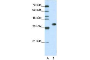 WB Suggested Anti-HNRPA3  Antibody Titration: 1. (HNRNPA3 抗体  (N-Term))