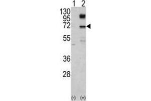 Western blot analysis of NFE2L2 (arrow) using NFE2L2 Antibody . (NRF2 抗体  (Ser40))