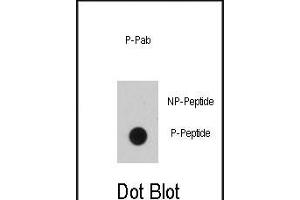 Dot blot analysis of anti-EGFR B1 Phospho-specific Pab (ABIN389891 and ABIN2839735) on nitrocellulose membrane. (EGFR 抗体  (pTyr1016))