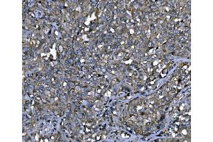 IHC analysis of ENAH/MENA using anti-ENAH/MENA antibody (ABIN7601316).