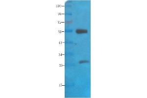 Western Blot using anti-polysialic acid antibody   Rat brain lysate was resolved on a 10% SDS PAGE gel and blots probed with  at 2 µg/ml before being detected by a secondary antibody. (Recombinant Polysialic Acid 抗体)