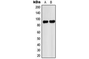 Western blot analysis of PNPLA8 expression in A549 (A), HeLa (B) whole cell lysates. (PNPLA8 抗体  (C-Term))