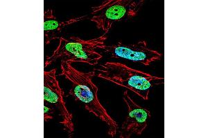 Fluorescent confocal image of Hela cell stained with NKX1-1 Antibody (Center) (ABIN655858 and ABIN2845265). (NKX1-1 抗体  (AA 230-258))