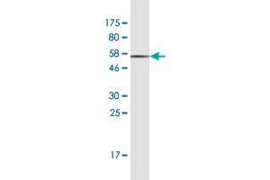 Western Blot detection against Immunogen (49. (CLTA 抗体  (AA 1-218))