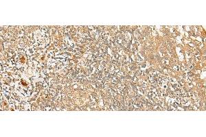 Immunohistochemistry of paraffin-embedded Human tonsil tissue using PROKR1 Polyclonal Antibody at dilution of 1:40(x200) (Prokineticin Receptor 1 抗体)
