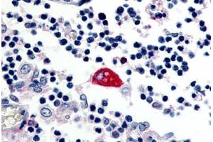 Human Macrophage (formalin-fixed, paraffin-embedded) stained with EMR3 antibody ABIN213514 at 2. (EMR3 抗体  (C-Term))